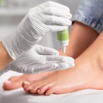 Aplikacja olejku oxyZONE OIL z oliwą ozonowaną i smoczą krwią
